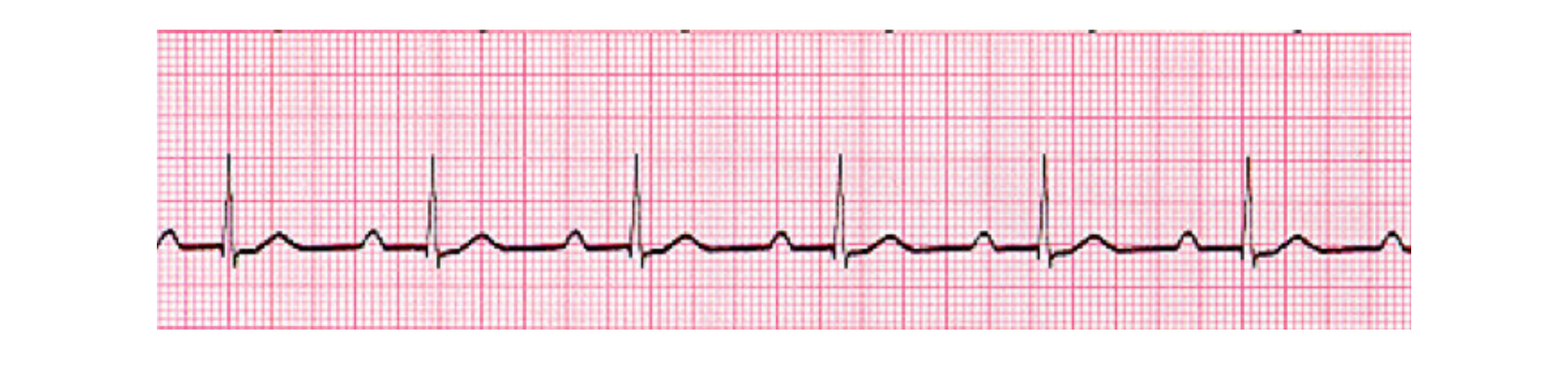 <p>How do you treat this</p>