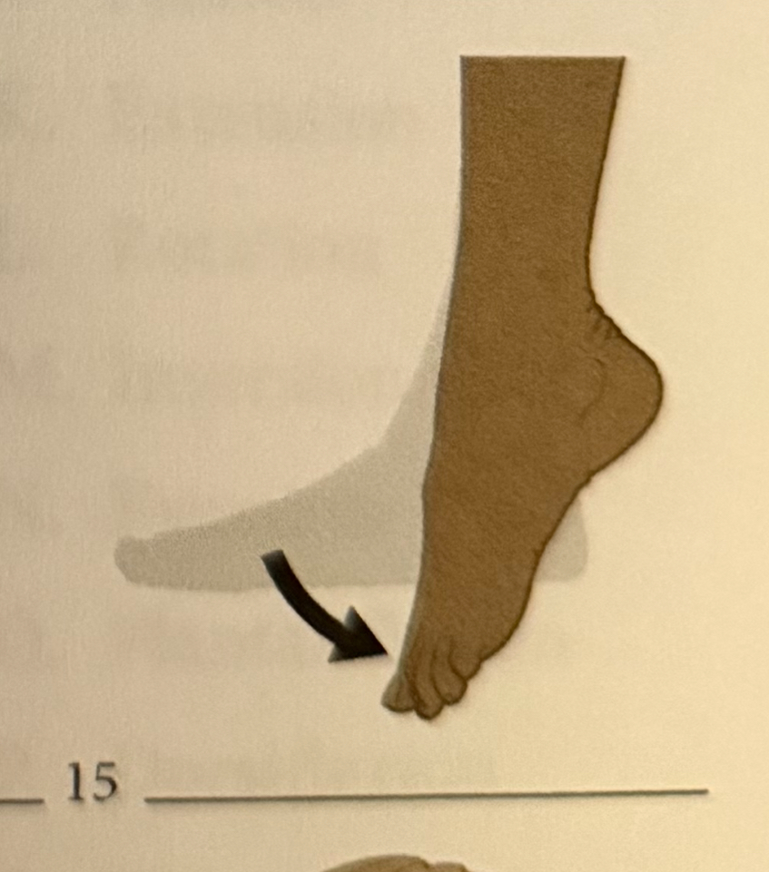 <p>raising the sole of the foot</p>
