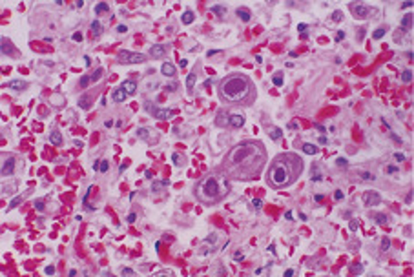 <p>Acidic dye that stains acidophilic structures red/pink</p>