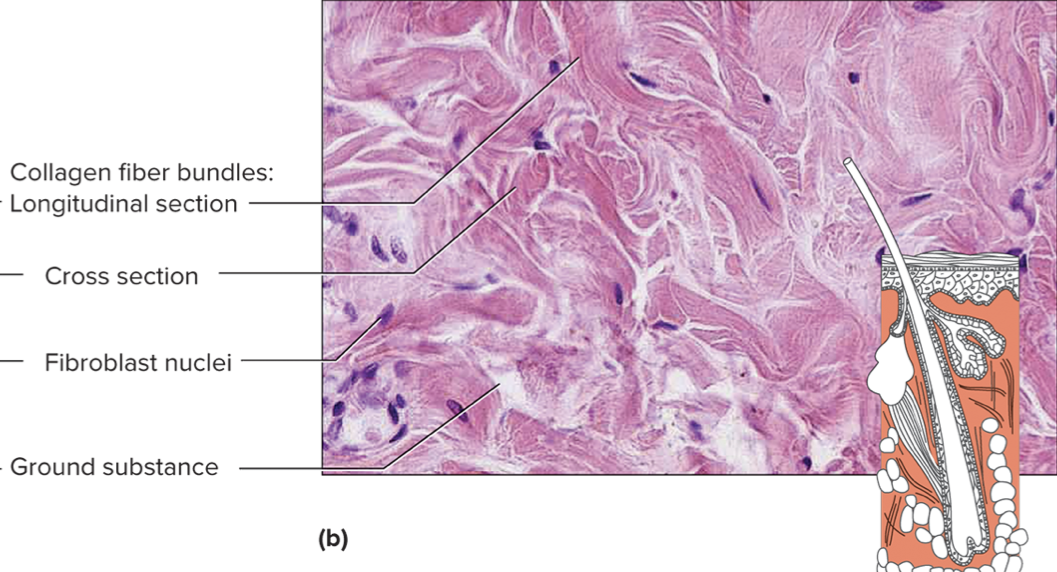 <p>what specific connective tissue is this? </p>