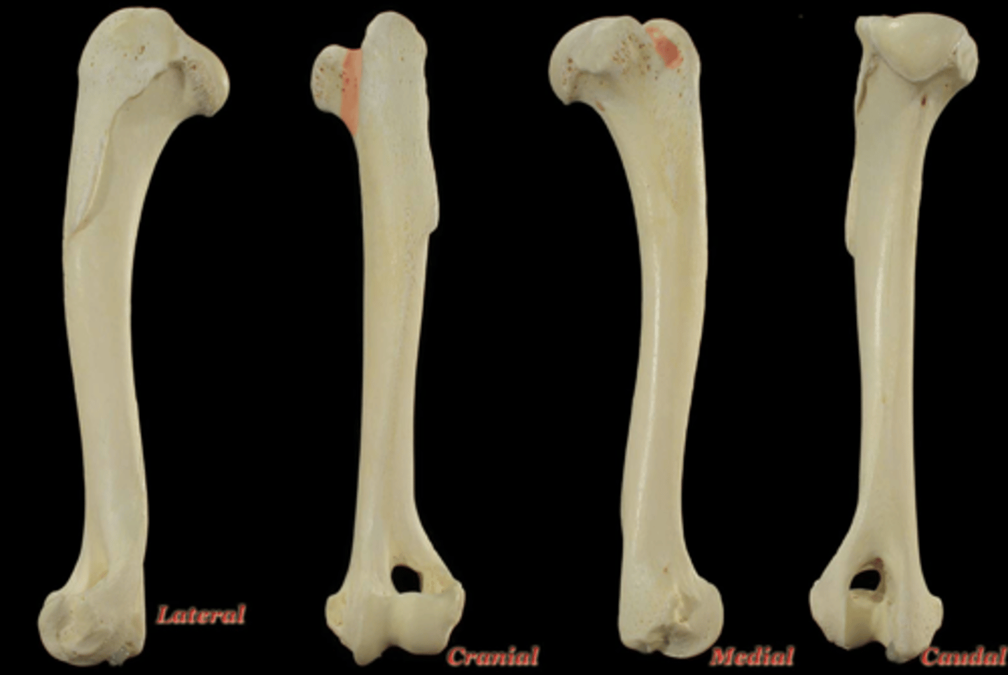 <p>What structure is highlighted in the picture?</p>