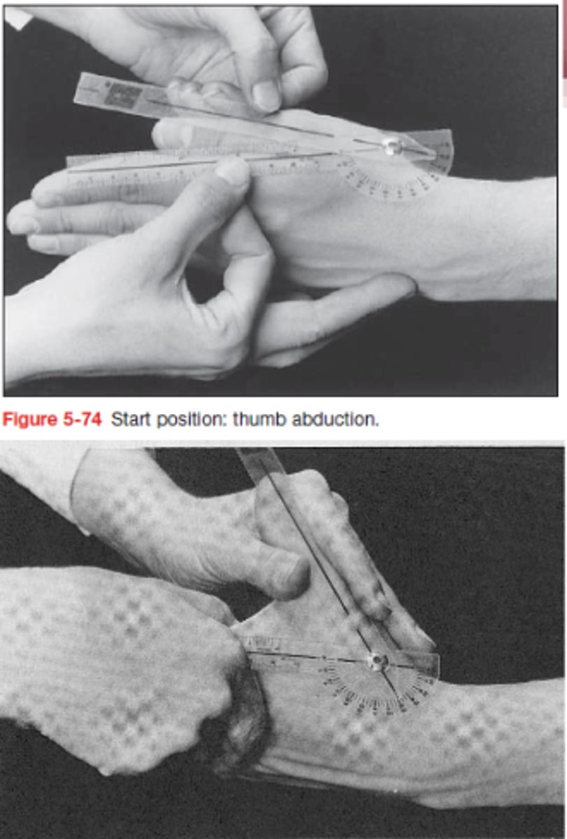 <p>Stabil szár: II. metacarpus (CMC) tengelye</p><p>Mobil szár: I. metacarpus tengelye</p><p>(a forgáspont pedig az I, II. MC basisa)</p>