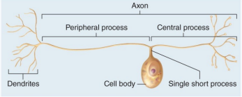 <p>unipolar </p>
