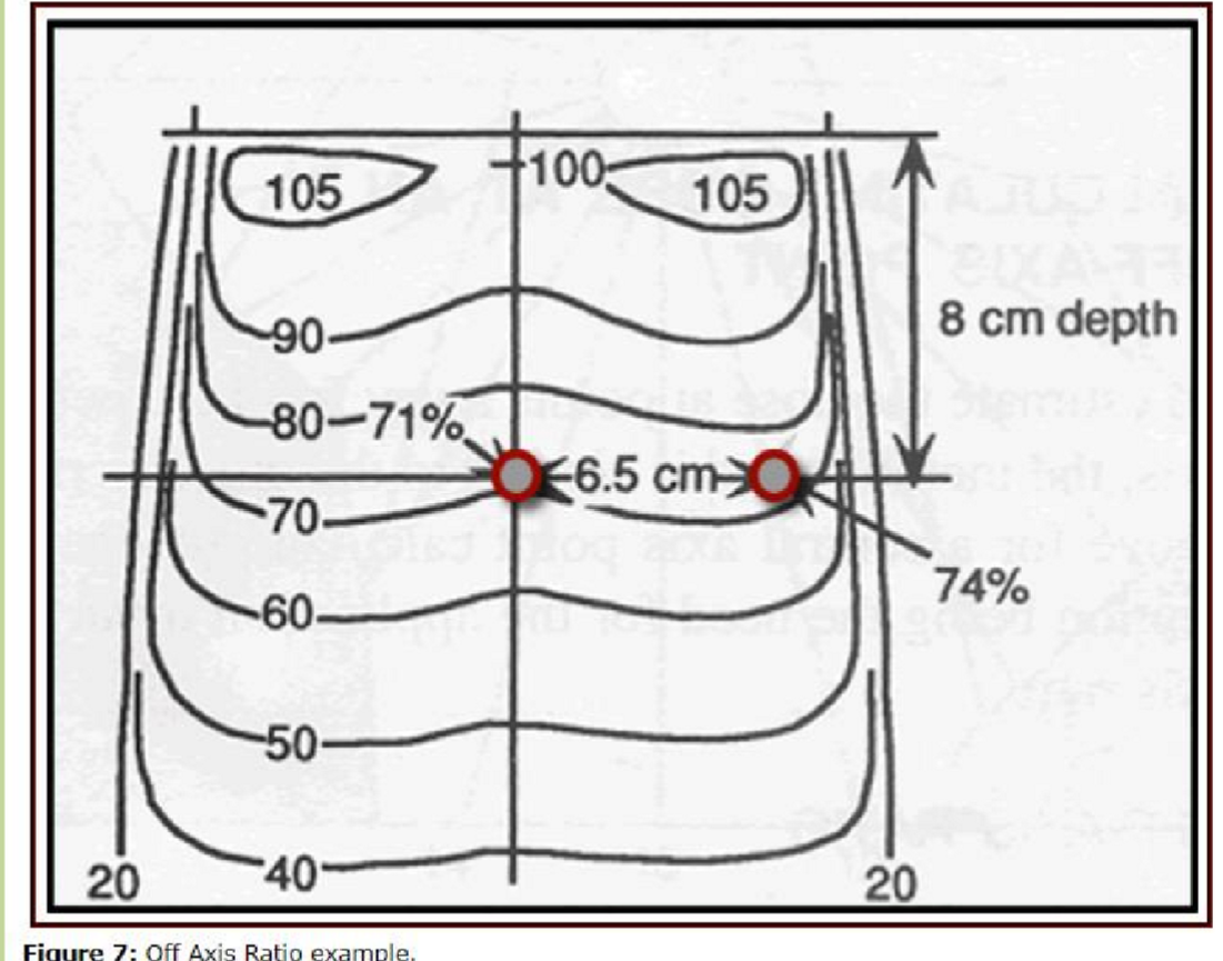 <p>Flattening filters create a smoother dose distribution across the treatment area, reducing dose variations and improving uniformity in the output of radiation beams. </p><ul><li><p>horns are also created as a side-effect</p></li></ul><p></p><p>without flattending filter, isodose is more bow shaped</p><p></p>