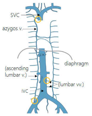 <p>Azygos and hemiazygos veins drain the posterior thoracic and posterior intercostal veins into the vena cava. But the azygos also offers a collateral passage for venous blood to bypass blockages in the venae cavae (cavo-caval anastomosis)</p><ul><li><p>Anastomoses in the yellow circles run into the superior vena cava to drain</p></li></ul><p></p>