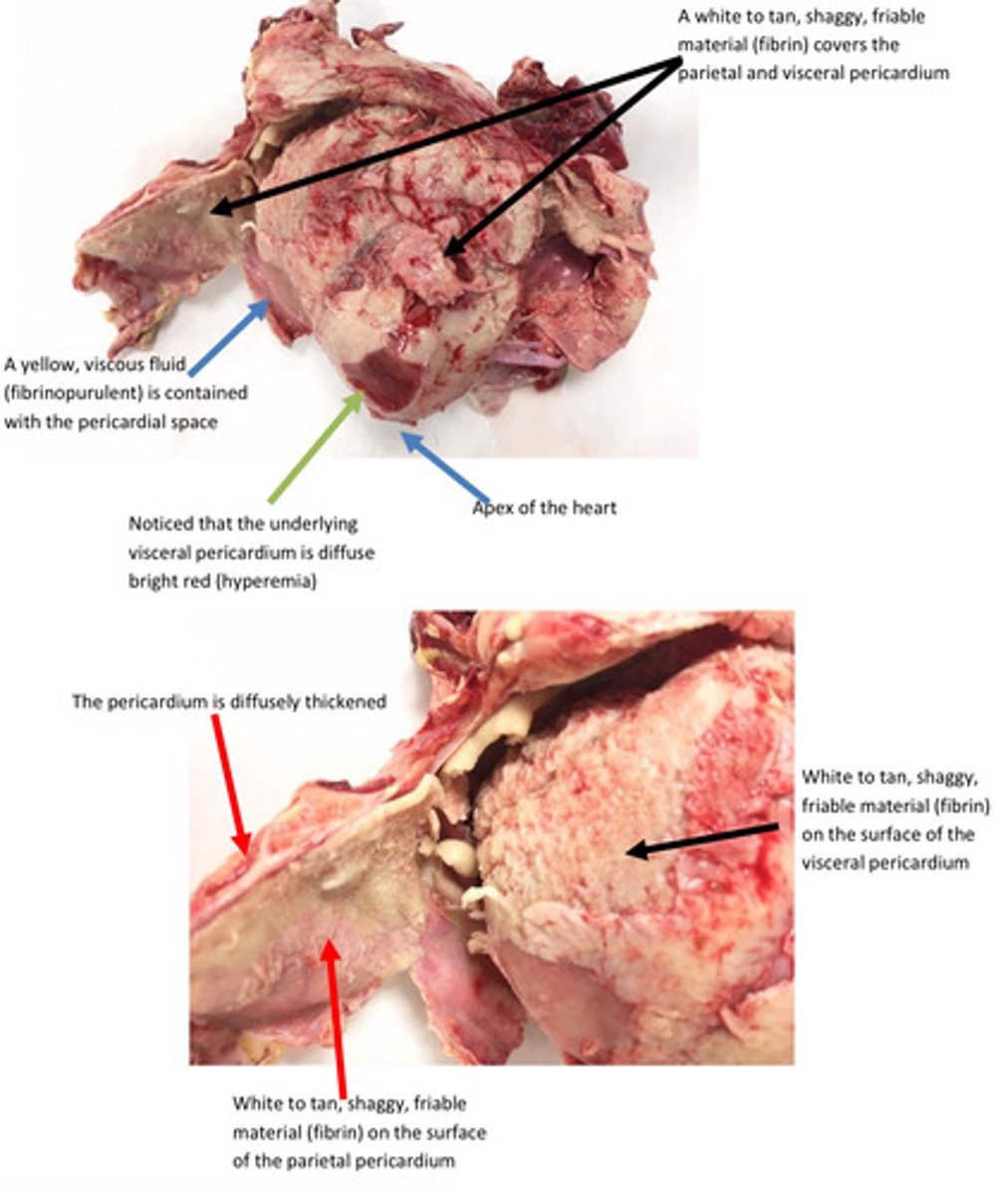 <p>Give morphological diagnosis</p>