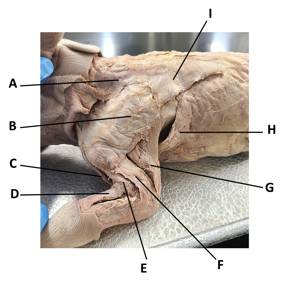 <p><span><span>Identify the muscle labeled with the letter A.</span></span></p>