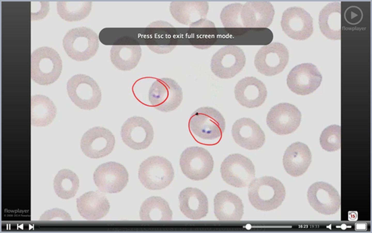 <p>wtf rbc5? cause?</p>