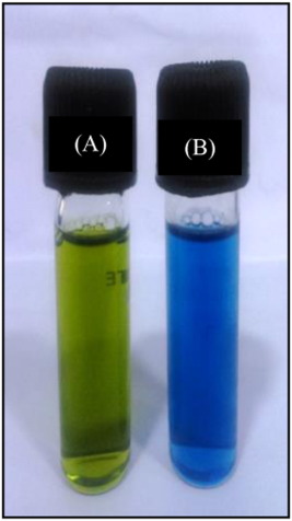 <p>elevated in dehydration, hemolysis, lipemia, laboratory error. Decreased in protein losing nephropathy, gastroenteropathy, liver failure, malnutrition, exudative skin disease, neonates, external blood loss, chronic effusions, hyperglobulinemia, multiple myeloma. one of the most important proteins in plasma or serum. It makes <strong>up 35% to 50% of the total plasma protein</strong> in most animals, and any significant state of hypoproteinemia is most likely caused by albumin loss. Hepatocytes synthesize albumin, and any diffuse liver disease may result in decreased albumin synthesis. Renal disease, dietary intake, and intestinal protein absorption may also influence the plasma albumin level. Albumin is the major binding and transport protein in the blood, and it is responsible for maintaining the osmotic pressure of the plasma. The primary photometric test for albumin in veterinary patients is the <strong>bromocresol green dye-binding method</strong>.</p>