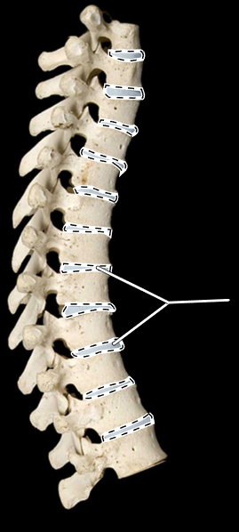 <p>What are the highlighted portions called?</p><p>What region of the vertebral column is this?</p>