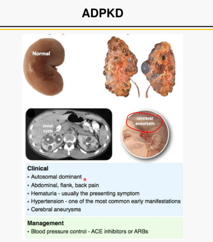 -often have HTN and abdominal mass (palpable kidneys)
-*family history*
-abdominal/ flank pain
-hematuria
-Hx of UTI/ nephrolithiasis