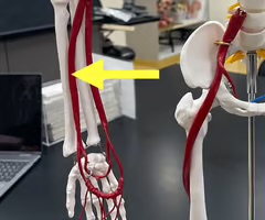 <p>Name the blood vessel.</p>