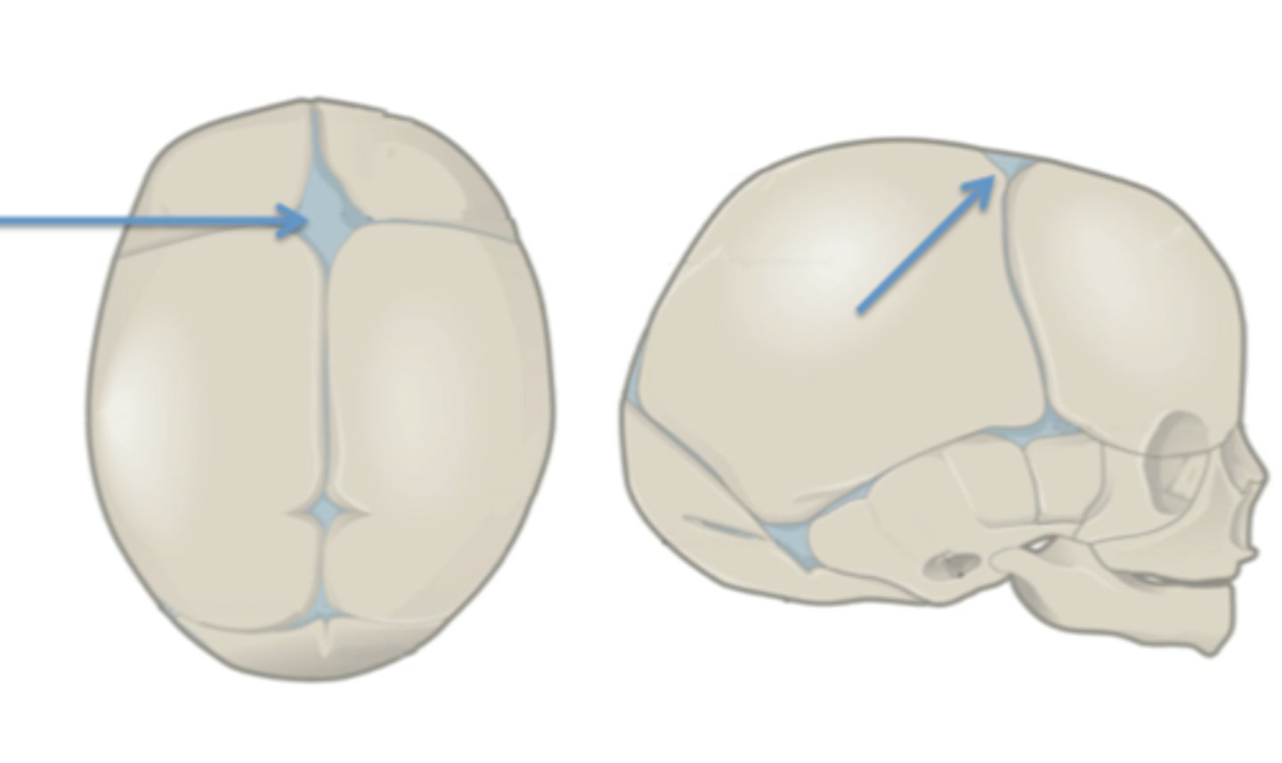 <p>Identify this fetal skull structure.</p>