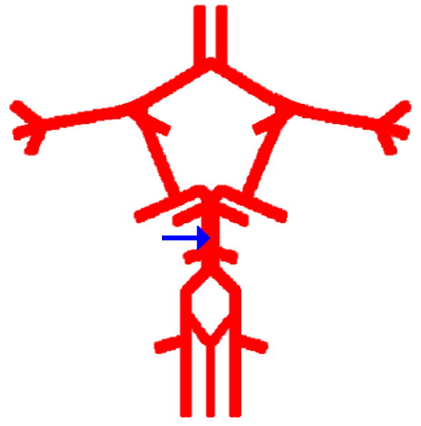 <p>Label this cerebral artery</p>