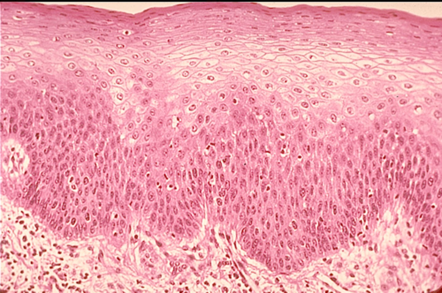 <p>example: epidermis of skin</p><p>function: protects from abrasion</p>