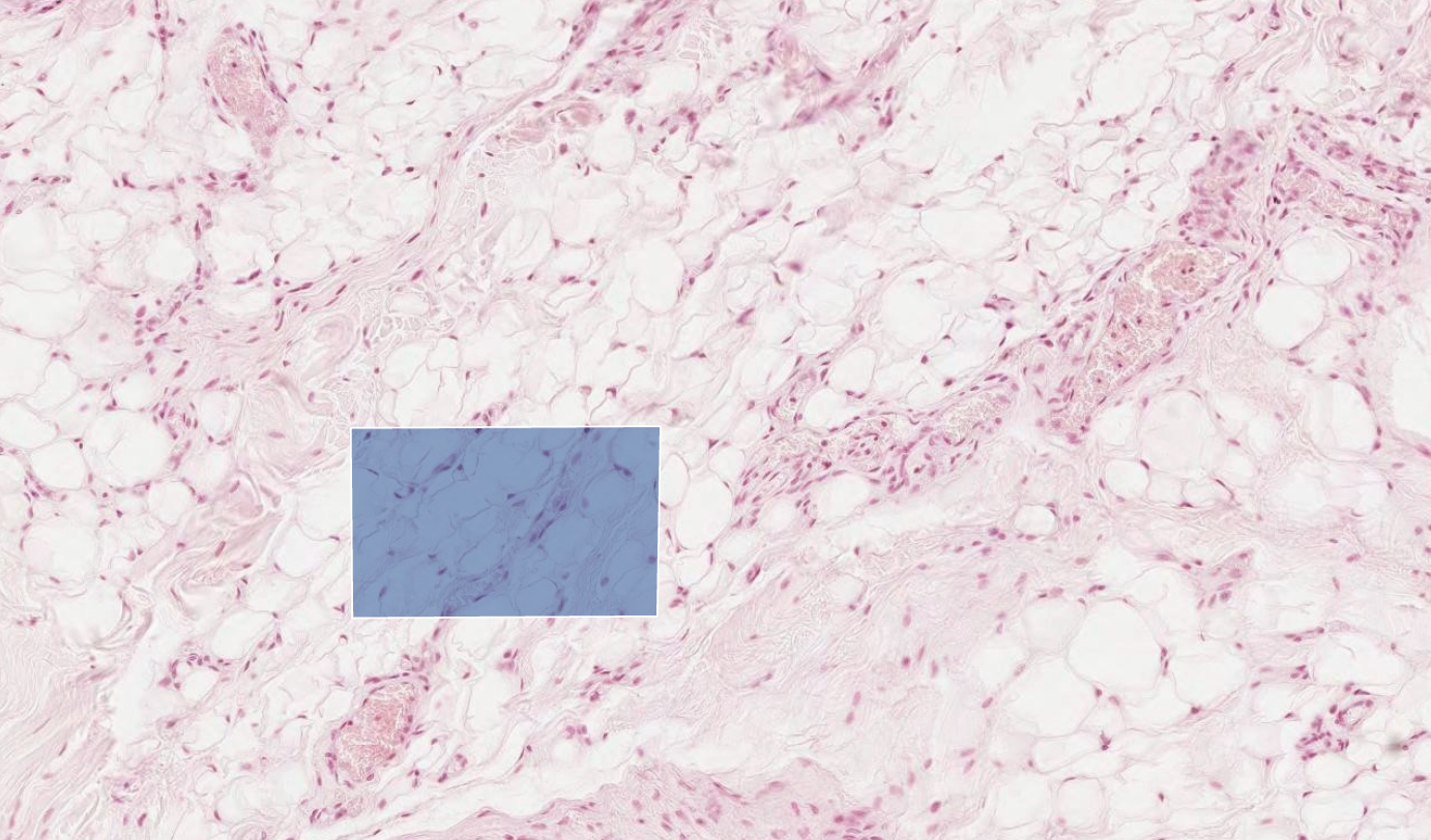 <p>identify layer of the skin</p>