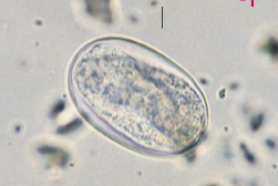 <p>intestinal threadworm that infects pigs</p>