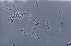 <p>Axial filament</p>