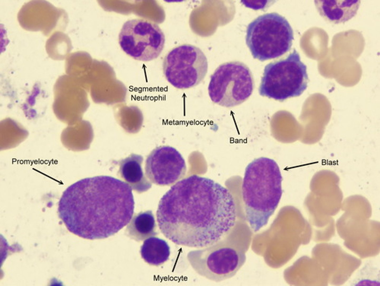<p>1. EOS = MBP</p><p>2. BAS = 1. Histadine 2. Heparin</p>