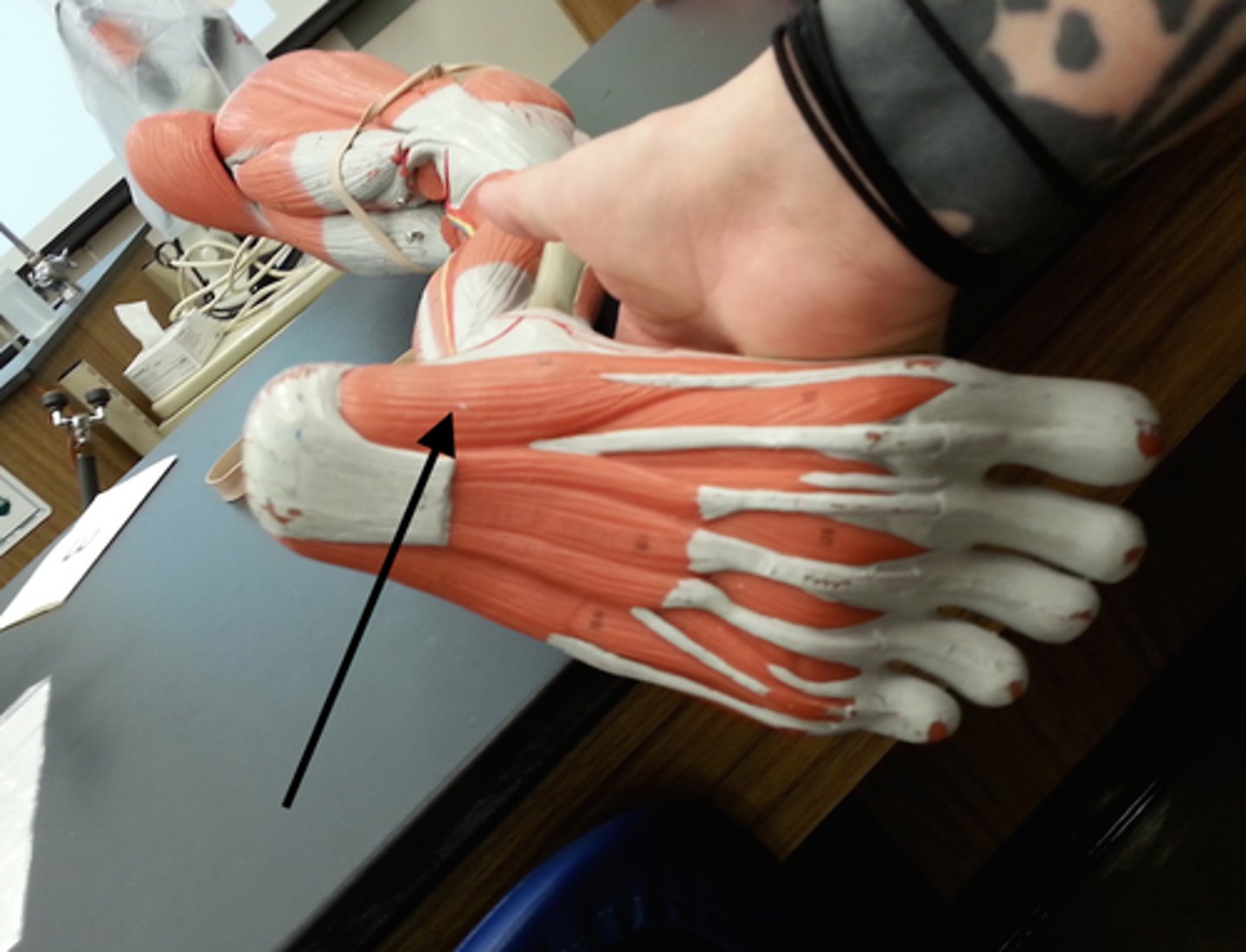 <p>A muscle that abducts the big toe.</p>