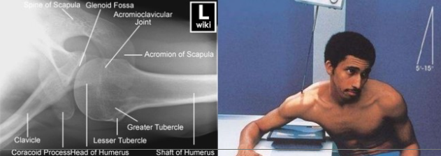 <p>Superoinferior Axial</p>