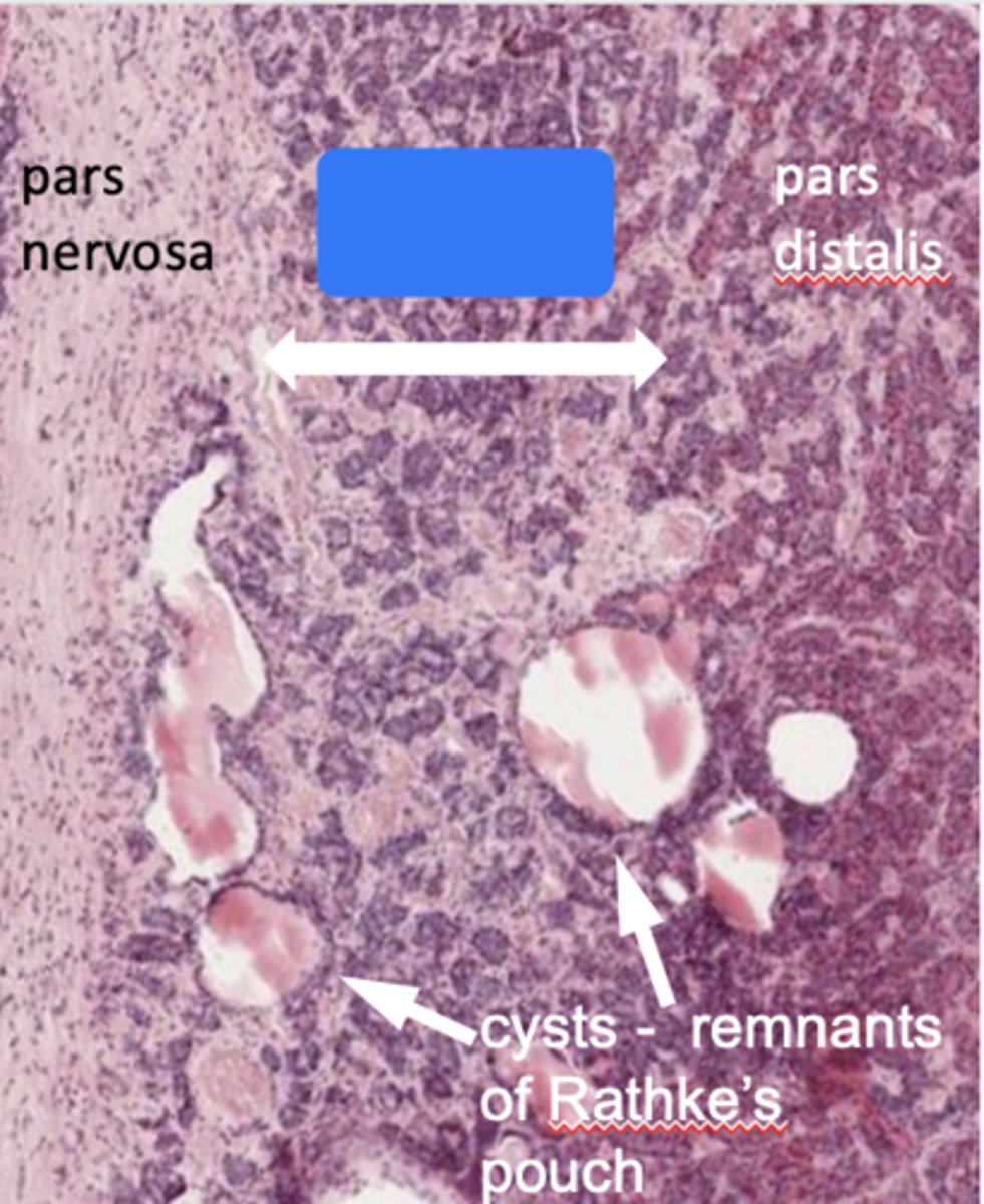<p>ID the section in blue:</p>