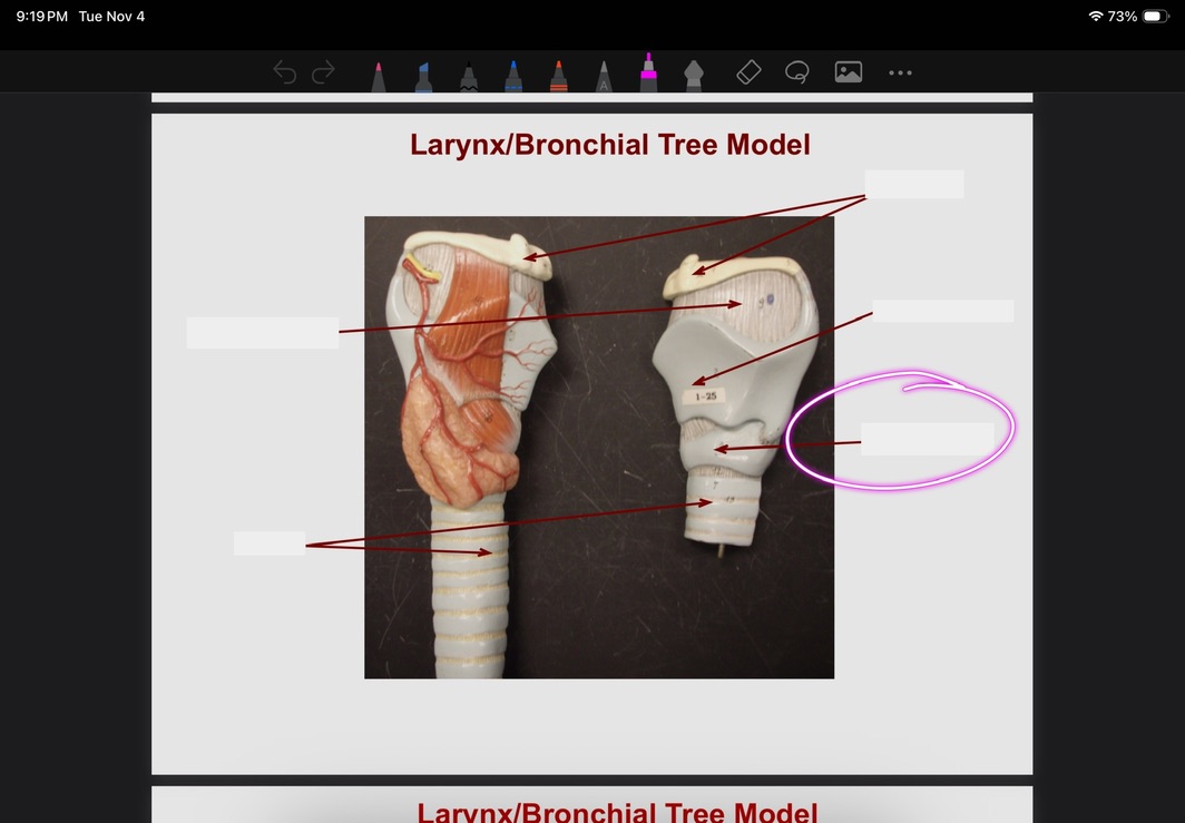 <p>What is this?</p>