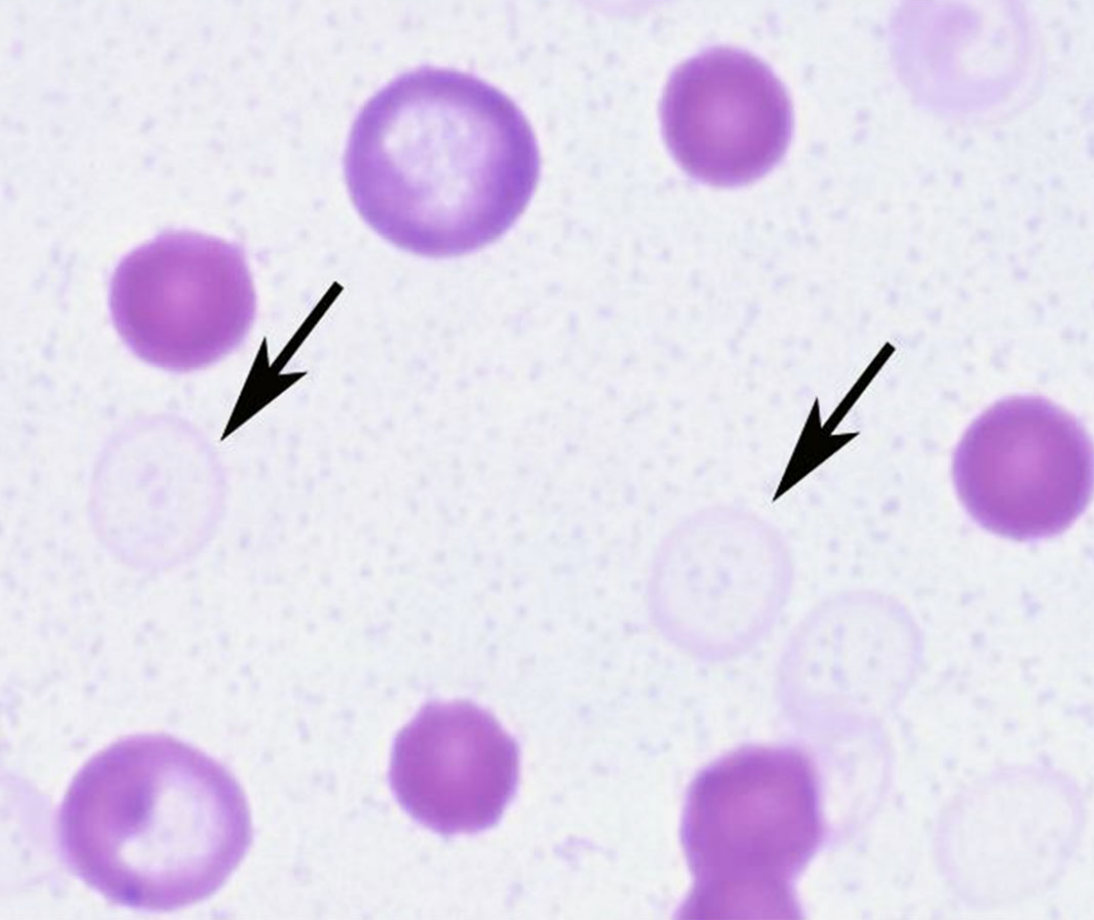 <ul><li><p>RBC membranes with little to no hemoglobin</p></li><li><p>primarily associated with <strong>intravascular IMHA</strong></p><ul><li><p>RBC releases Hb into plasma</p></li></ul></li></ul><p></p>