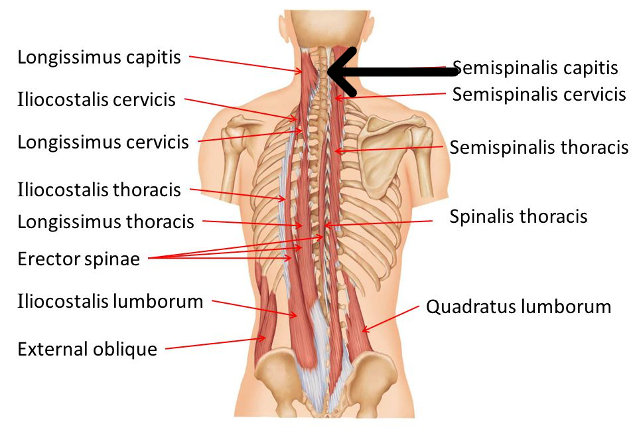 <p>origin: C3-T-5</p><p>insertion: mastoid process (posteriorly)</p><p>action: extend the head</p>