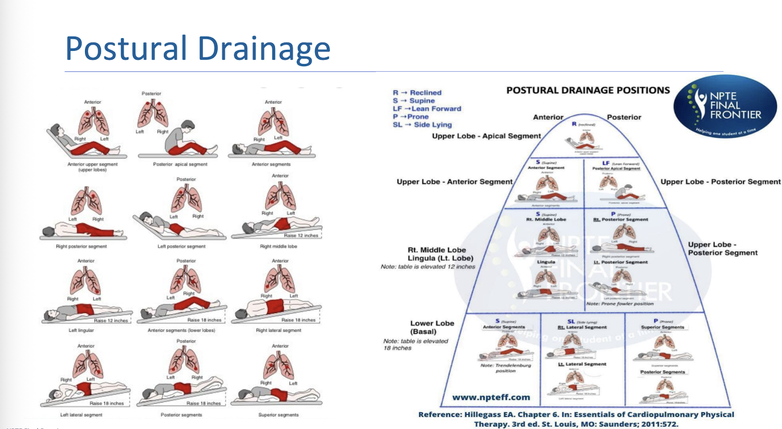 <p>Key Positions:</p><ul><li><p>Prone lying on a bed with two pillows under pelvis:</p></li><li><p>Sitting on a chair, leaning forwards over folded pillow: </p></li><li><p>Supine lying on a bed with pillows under knee:</p></li><li><p>Sitting in a recliner, leaning slightly backwards:</p></li></ul><p></p>