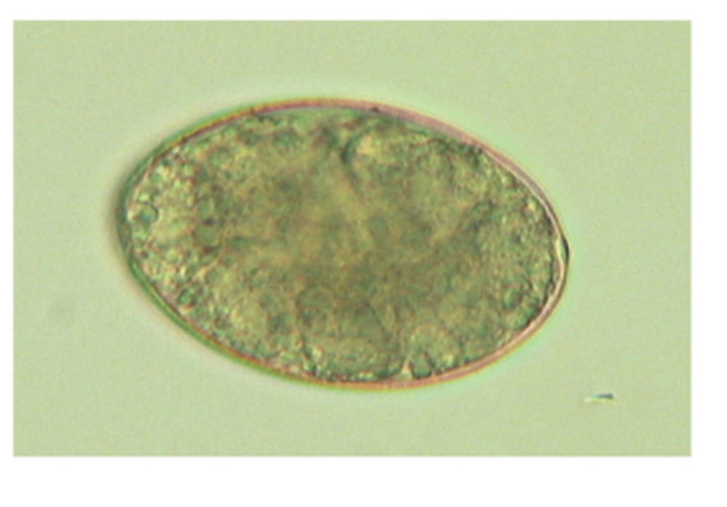 <p>This pseudophyllidean-type ovum is produced by a pseudotapeworm that has a definitive host of dogs, cats, and humans with a second intermediate host of fish. This cotyloda tapeworm is</p>