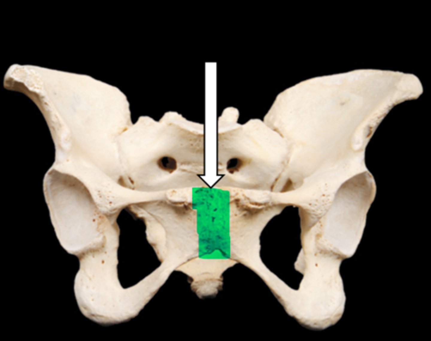 <p>name the part</p>