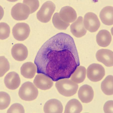 <p>What is this leukocyte showing?</p>