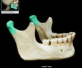 <p>the rounded end of the condyloid process of the mandible; articulates with mandibular fossa (temporal bone) to form temporomandibular joint (TMJ)</p>