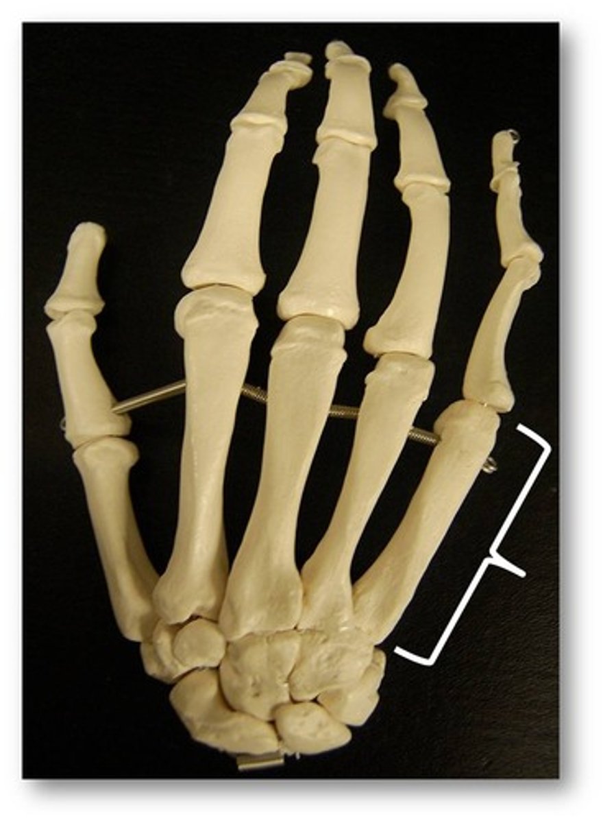 <p>Name these bones of the hand.</p>