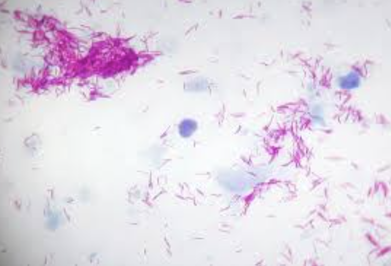 What example of acid-fast staining is this?