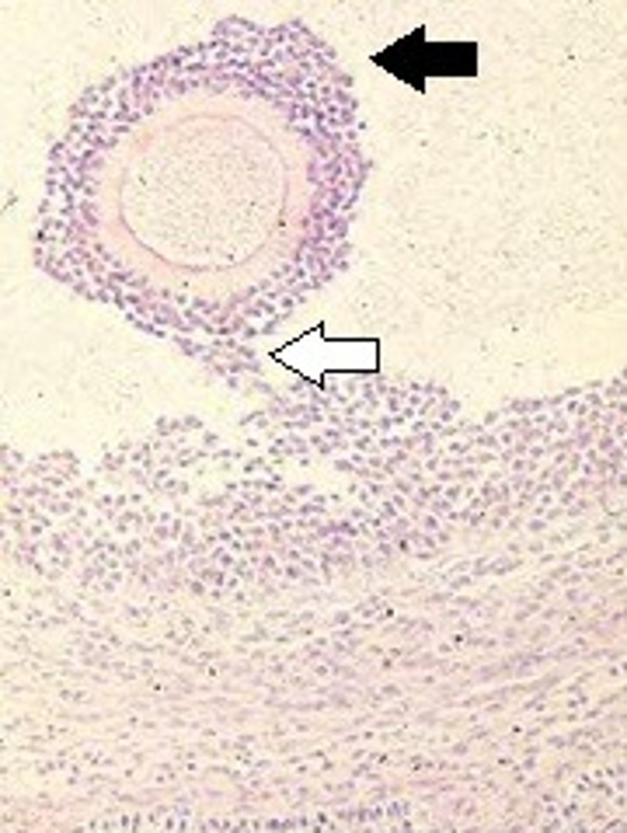 <p>What follicle has these characteristics and what is indicated by the black &amp; white arrows</p>