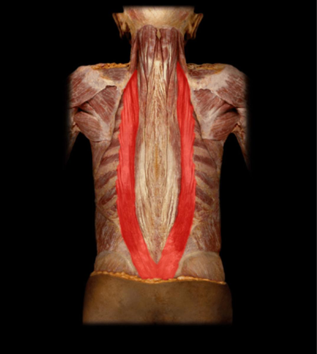 <p>lateral</p>