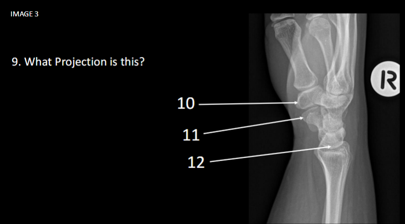 <p>What is number 11</p>