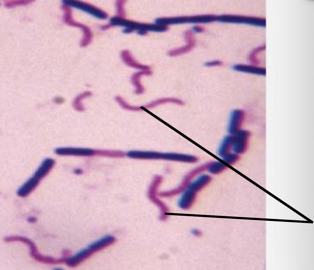 <p>Is the bacteria pointed at gram positive or negative</p>