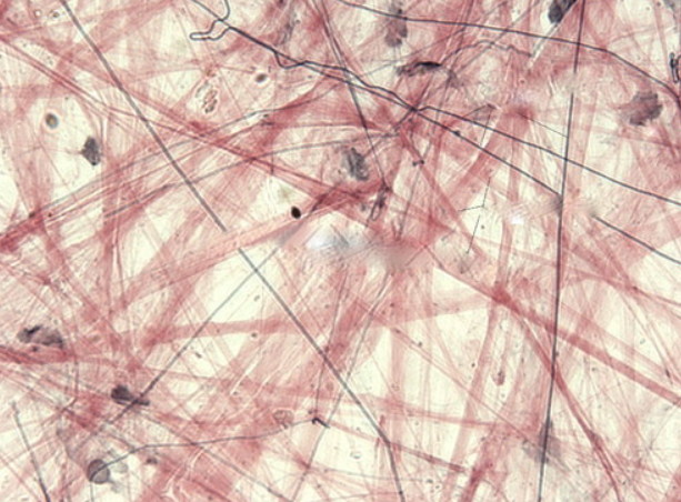 <p>(most common)<br>- underlies almost all the epithelia of the body and surrounds almost all the small nerves blood vessels</p>