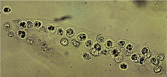 <ol><li><p>Identify structure.</p></li><li><p>What is this structure associated with?</p></li></ol><p></p>