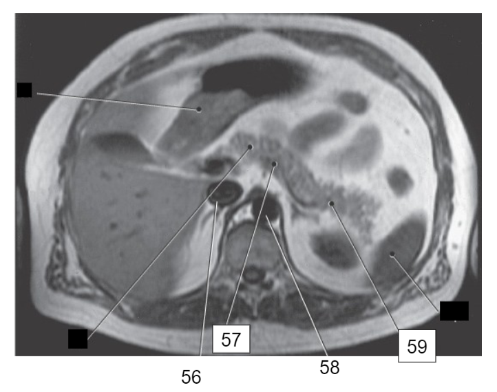 <p>identify 56</p>