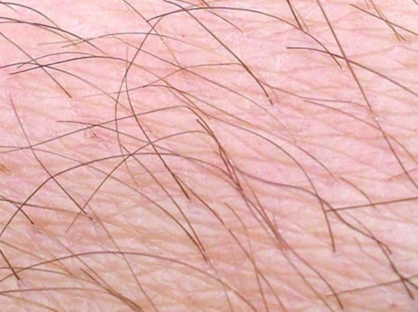 <p>skin with hair; covers MOST of our body<br>- mechanoreceptor: <strong>hair follicle nerve plexus</strong>; physical movement of the hair themselves triggers a signal (mechanotransduction)</p><ul><li><p>as hairs move proteins are being pulled open and closed</p></li></ul>