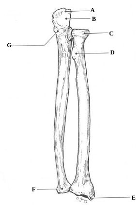What bones are these?