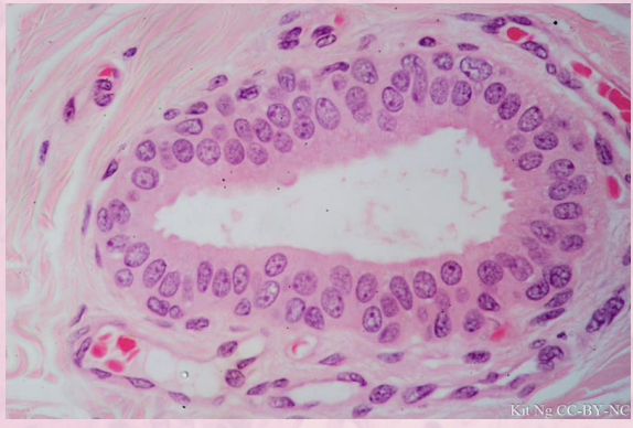 <p>can be found in certain glands and ducts </p>