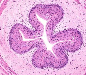 <p>Identify this epithelial tissue, where it is found, and its function.</p>