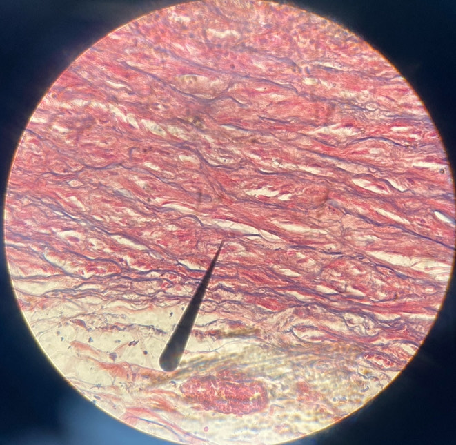 <p>example: aorta<br>function: recoils if stretched</p>