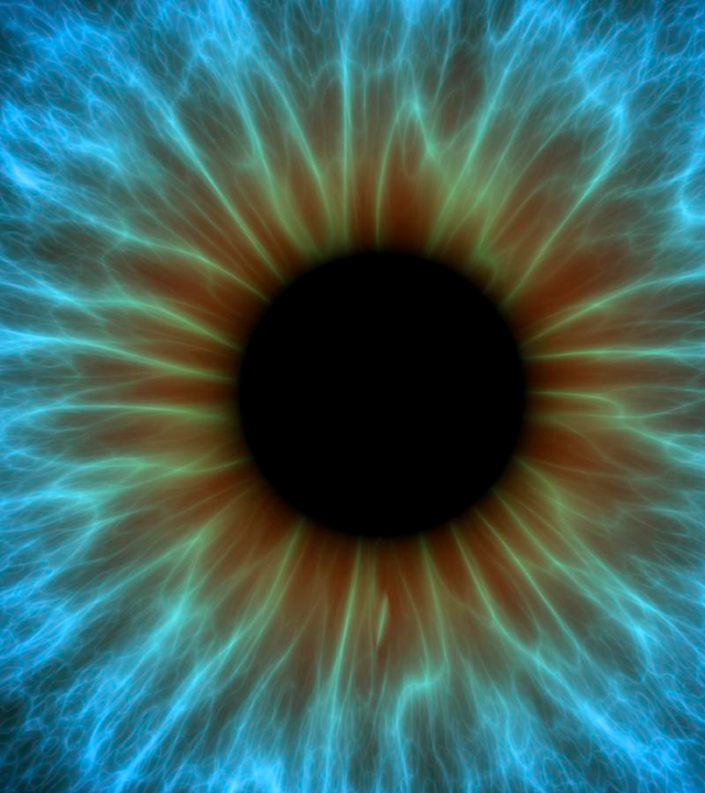 <p>Smooth muscle that forms small discrete groups of cells for delicate movement</p><ul><li><p>Iris and Ciliary body of eye, Small blood vessels and  air passageways</p></li></ul><p></p><p>Require specific impulses from nervous system to contract</p><ul><li><p>Changes in light, oxygen demand</p></li></ul><p></p>