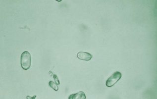 Monohydrate calcium oxalate crystals